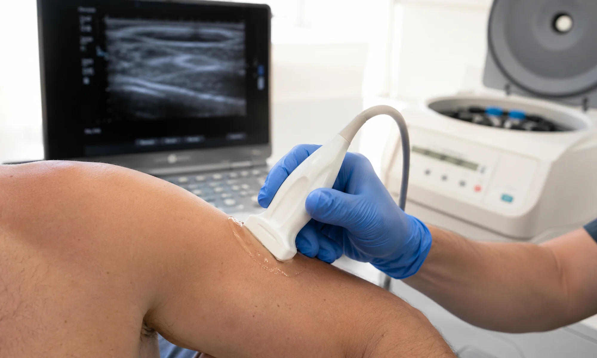Aplicación de PRP en rodilla para artrosis sin rostros visibles