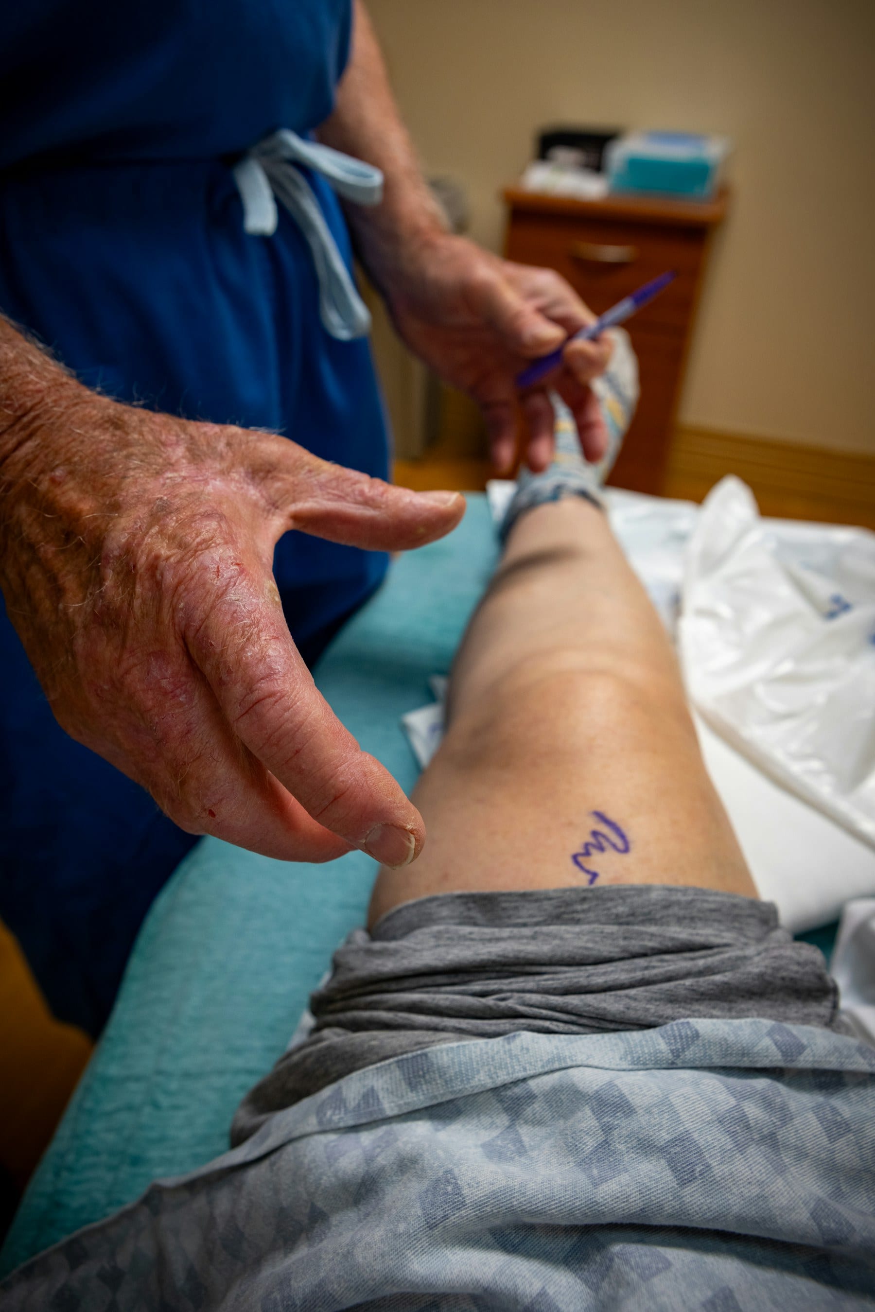 Traumatólogo explorando y marcando la rodilla antes de una infiltración